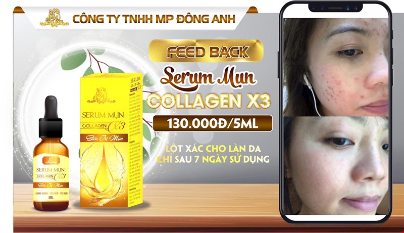 Serum Trị Mụn Collagen X3