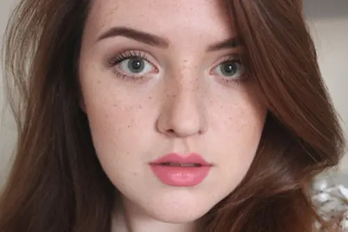 Tàn Nhang Trên Mặt Là Gì? Nguyên Nhân Và Cách Trị Hiệu Quả Toàn Diện